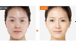 新疆整形爆料案件最新消息,真相逐步浮出水面